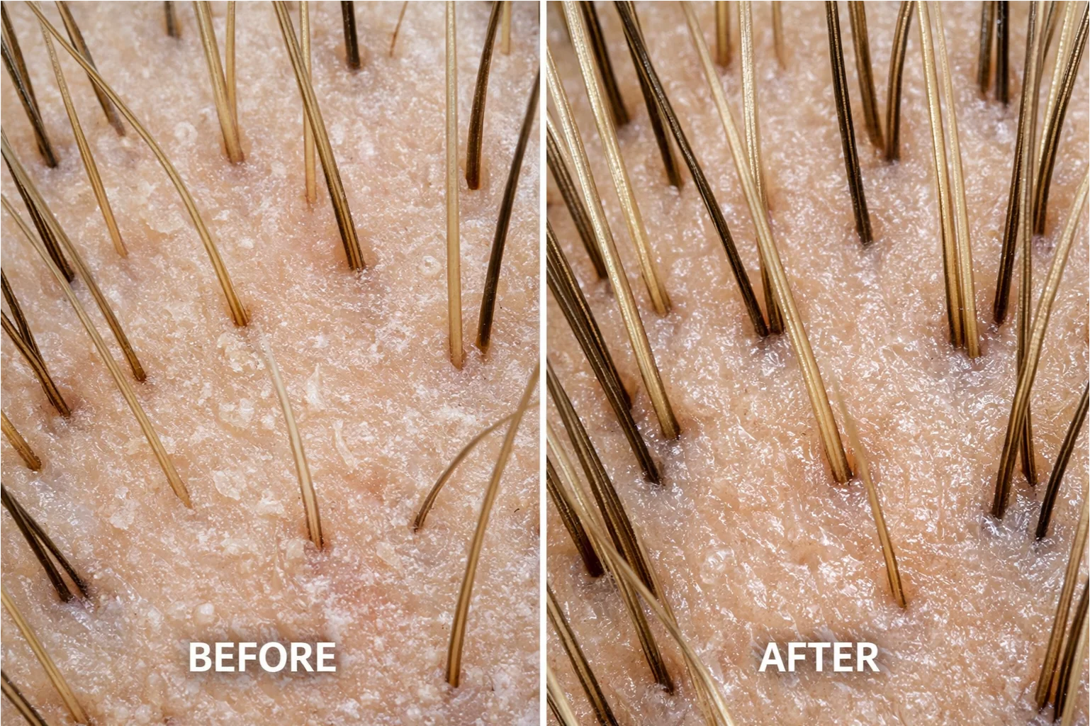 Repair & Hair Thickening For All Hair Types - 10 Minute Miracle - Mega Set - Image 3