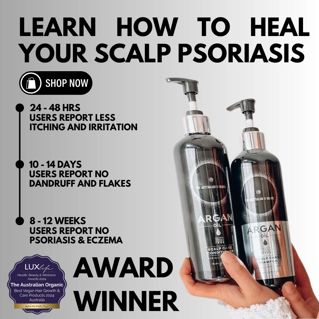 Scalp & Body Care For Your: Psoriasis, Eczema, Itching, Sores, Scabs & Dandruff - Relief in 10 Minutes - Conditioner - Image 7