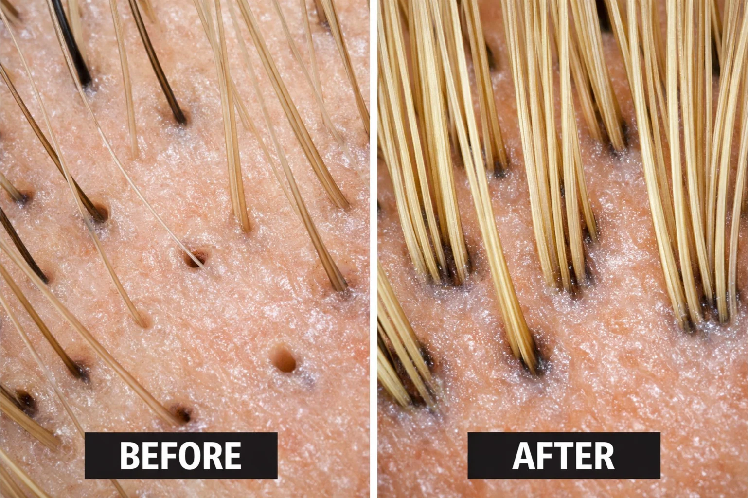 Stop Hair Loss & Real Hair Regrowth for All Hair Types - 10 Minute Miracle - Spray 100ml - Image 4