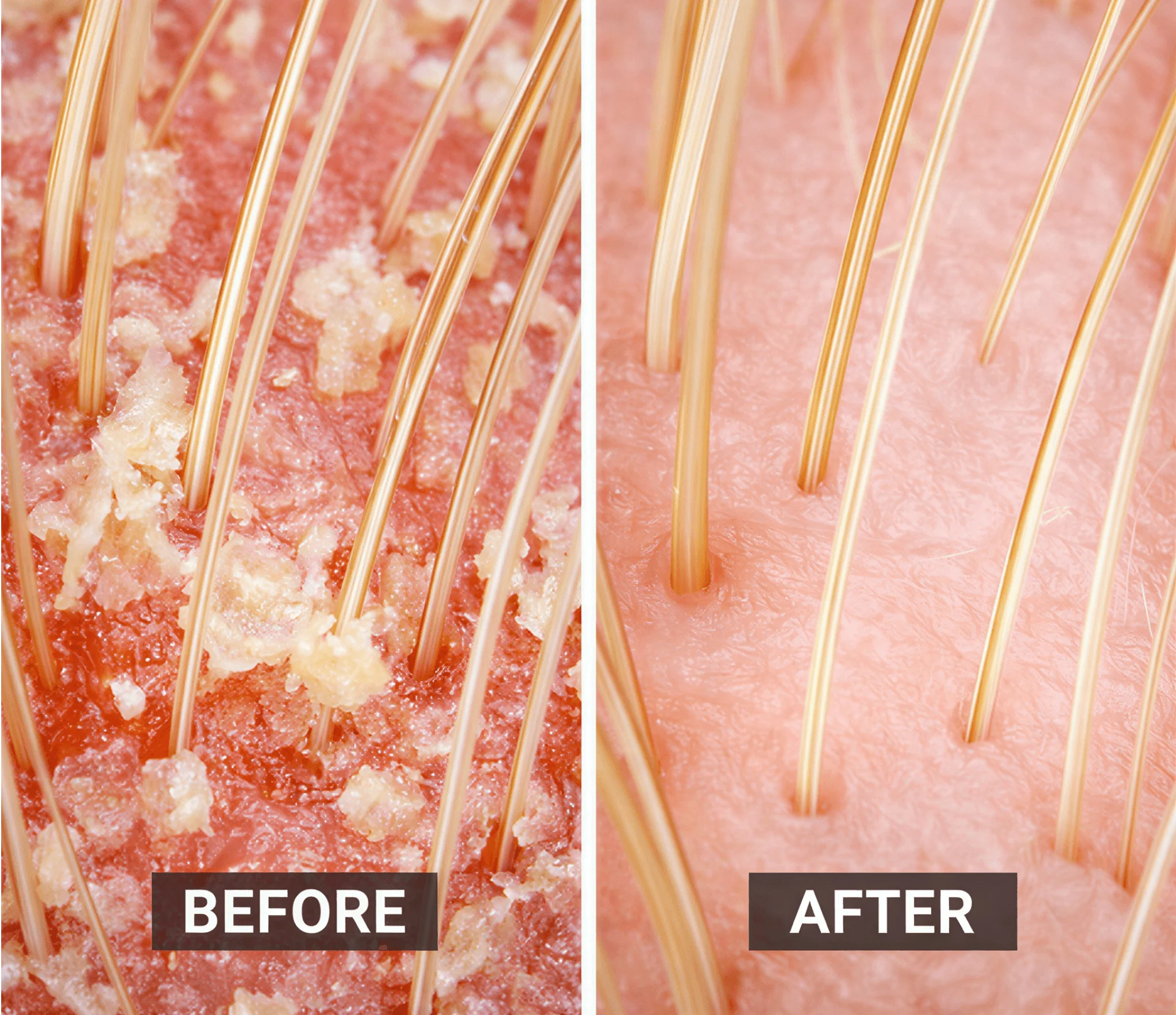Scalp & Body Care For Your: Psoriasis, Eczema, Itching, Sores, Scabs & Dandruff - Relief in 10 Minutes - Shampoo - Image 5