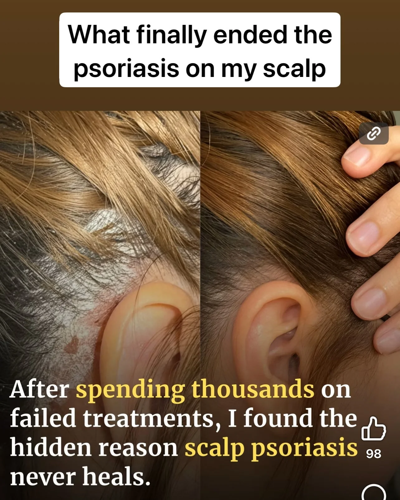 Scalp & Body Care For Your: Psoriasis, Eczema, Itching, Sores, Scabs & Dandruff - Relief in 10 Minutes - Shampoo - Image 3